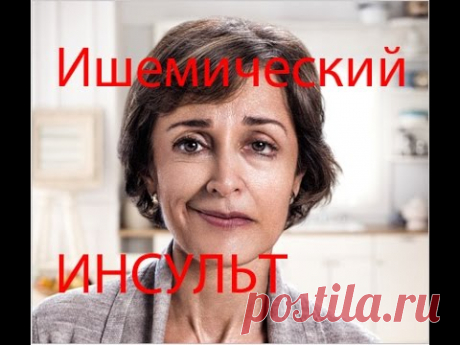 Ишемический инсульт