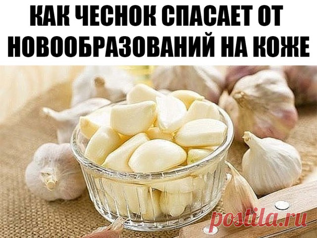 КАК ЧЕСНОК СПАСАЕТ ОТ НОВООБРАЗОВАНИЙ НА КОЖЕ? 

Есть очень эффективный рецепт для того, чтобы избавиться от БОРОДАВКИили папилломы, которые появились на коже и вызывают опасения, ведь случайным движением или при падении есть шанс отрыва и кровотечения в области новообразования, а оперативное вмешательство всегда вызывало опасения и страх. Народная медицина знает решение, данный рецепт помог уже не одному человеку. 

Если у вас бородавка или ПАПИЛЛОМА, то для того, чтобы б...