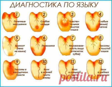 (75) Одноклассники