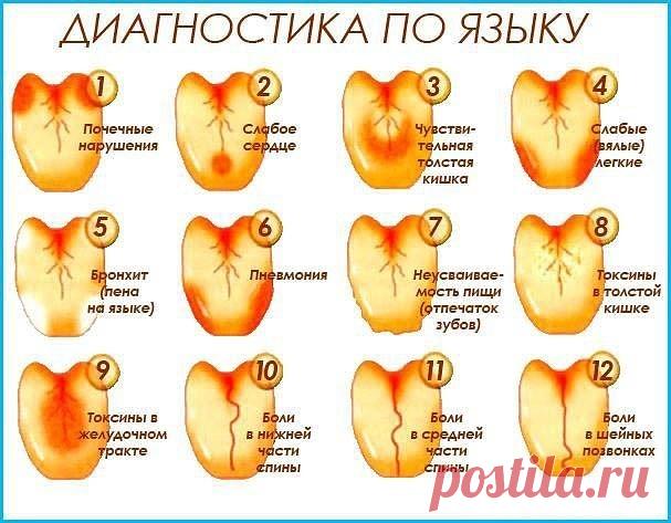 (75) Одноклассники