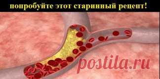Попробуйте этот старинный рецепт! Всего 7 дней лечения! | АйДаМы | У нас Всегда лучшее