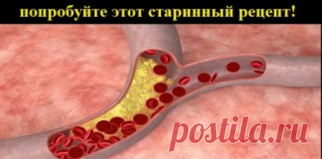 Попробуйте этот старинный рецепт! Всего 7 дней лечения! | АйДаМы | У нас Всегда лучшее