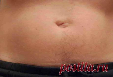 Некрасивый пупок  (код МКБ-10; код МКБ-11): описание, причины, симптомы, как лечить | Клиника лечения боли: врачи онлайн