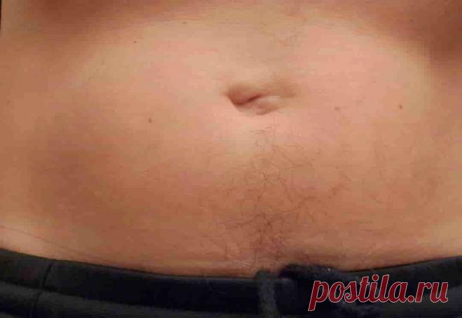 Некрасивый пупок  (код МКБ-10; код МКБ-11): описание, причины, симптомы, как лечить | Клиника лечения боли: врачи онлайн