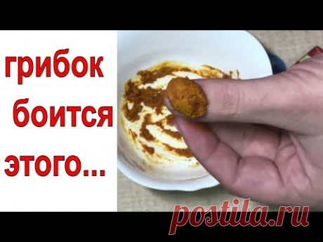 ГРИБОК НОГТЕЙ! простой и дешёвый способ избавиться от грибка