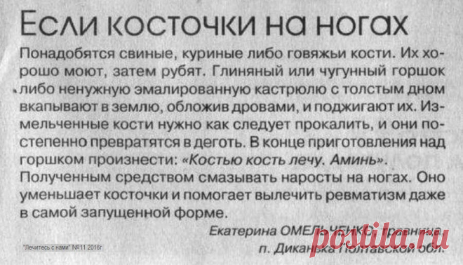 Если косточки на ногах
