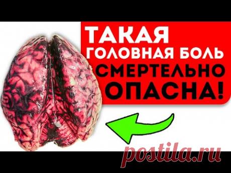 Когда головная боль - смертельно опасная? Инсульт, менингит, кровоизлияние в мозг!