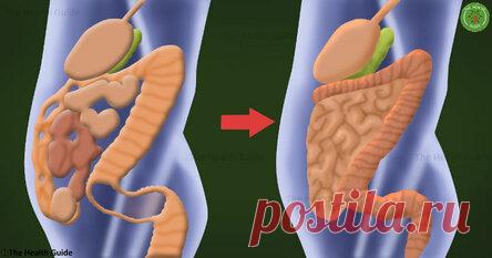 Как избавиться от 15 кг токсинов, отложенных в вашей толстой кишке, с помощью всего 2 ингредиентов! Стоит попробовать! Ничего сложного! Толстая кишка является одним из наиболее важных органов в организме, потому что она регулирует иммунную систему, помогает процессу пищеварения и поддерживает водный баланс в организме. Поэтому, когда толстая кишка не функционирует на 100%, токсичные отходы начинают накапливаться в организме. За период всей нашей жизни более 30 000 литров ж...