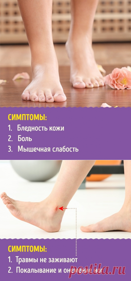 9 проблем с ногами, которые сообщат о серьезных болезнях | Женский онлан журнал | Page 3