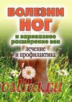 Болезни ног и варикозное расширение вен. Лечение и профилактика