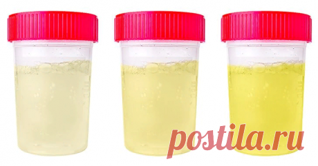 7 вещей, которые ваша моча пытается рассказать о вашем здоровье | Лисичка | Яндекс Дзен