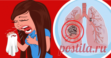 «Невидимые» симптомы рака лёгких. Их знание может спасти вам жизнь . Милая Я