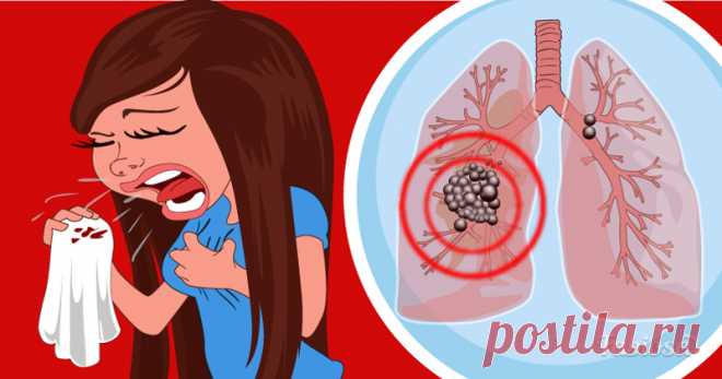 «Невидимые» симптомы рака лёгких. Их знание может спасти вам жизнь . Милая Я
