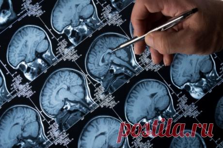Вскрыть мозг. Врач-нейрохирург открыл секреты профессии. В день нейрохирургии, который отмечается 8 апреля, aif.ru расспросил о секретах профессии врача с огромным стажем.