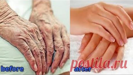 Ellerinizi 10 Yaş Daha Genç Gösterin - Ellerdeki Kırışıklıkları Giderin - Cilt Bakımı