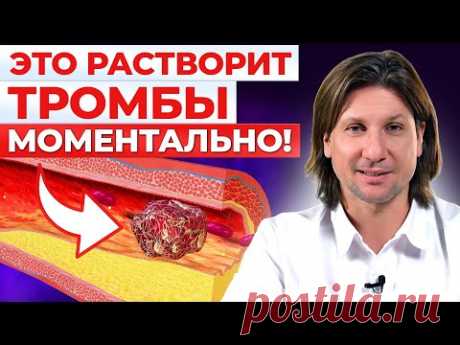 ЭТИ продукты разжижают ТРОМБЫ! Как спасти себя от тромбоза?
