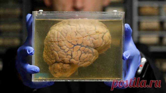 2-9-24--Доктор Эбер обещает ПРОДЛИТЬ ЖИЗНЬ с помощью «ЗАМЕНЫ» МОЗГА