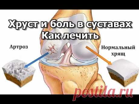 Хруст и боль в суставах - Как лечить