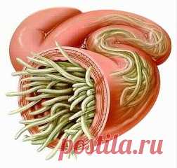 ✔ ПОЛЕЗНЫЕ СОВЕТЫ : 
СОВЕТ 1 : МЕДОВАЯ ВОДА ИЗГОНИТ ПАРАЗИТОВ , ПОМОЖЕТ ПОХУДЕТЬ И МНОГО ДРУГОЕ !
Чтобы НЕ потерять рецепт Жми КЛАСС и рецепт останется в твоей ленте !
Одну чайную ложку мёда развести в стакане сырой воды.
Получаем 30% раствор мёда, который по составу идентичен плазме крови. Мёд в
сырой воде формирует кластерные связи (структурирует ее). Это повышает её
целебные свойства. Медовая вода усваивается организмом быстро и полностью.
Эффект медовой воды
Нормализуе...