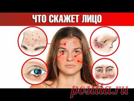 Болезни налицо. 18 признаков, которые расскажут о проблемах