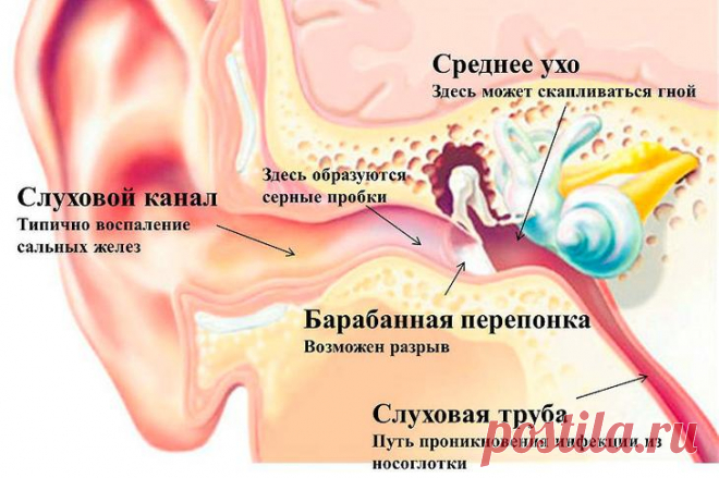 Лечение ушной пробки в домашних условиях