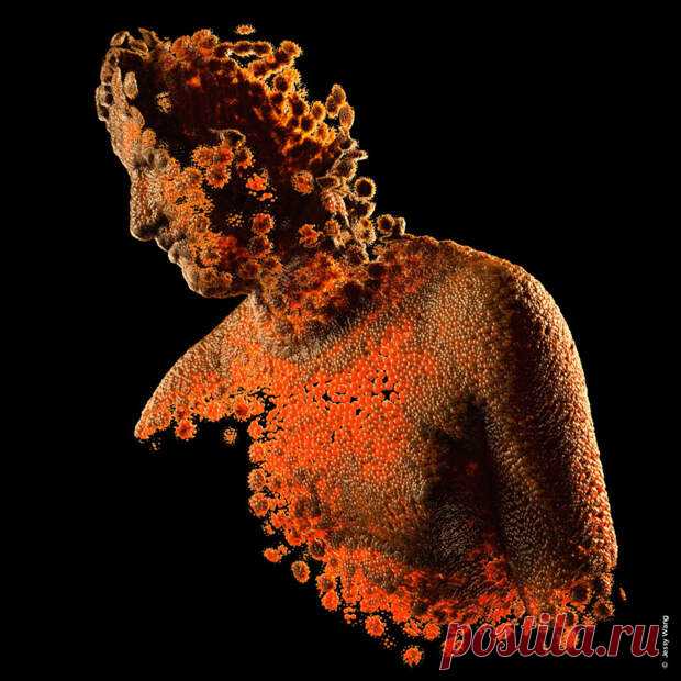 (48) Не просто грипп. К каким неврологическим и когнитивным нарушениям приводят гриппозные инфекции - ПолонСил.ру - социальная сеть здоровья - 2 марта - 43541086895 - Медиаплатформа МирТесен Эпидемии гриппа накрывают нас каждый год. Мы настолько к ним привыкли, что воспринимаем их как обыденность и забываем о таящейся угрозе. Гриппозные инфекции атакуют не только органы дыхания, но также центральную нервную систему, что приводит к гибели нейронов, развитию хронической уста...