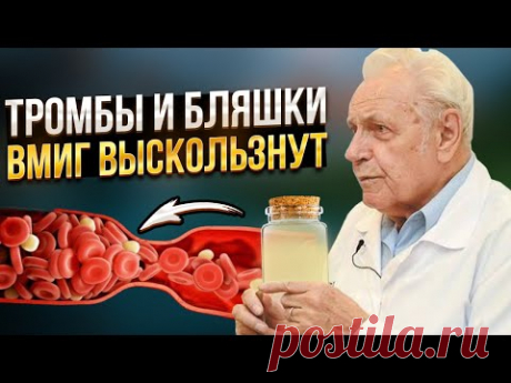 Неумывакин: тромбы и бляшки ужасно боятся простого