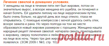 Жировик (липома) на лице и теле – Причины – Лечение жировика - Как избавиться от жировика |
