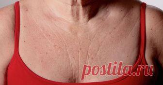 Эти 3 супер средства быстро устранят морщины на груди и шее - вы будете чувствовать себя намного моложе! - Страница 2 из 2 1. Маска из яиц, огурца и кокосового масла Применяйте эту маску один раз в неделю. Этого достаточно, чтобы за короткое время вы увидели прекрасную трансформацию. Это связано с различными питательными веществами яичного желтка и невероятной антиоксидантной способностью огурца и кокосового масла. Ингредиенты: 1 огурец (свежий или замороженный) 1 яичный ж...