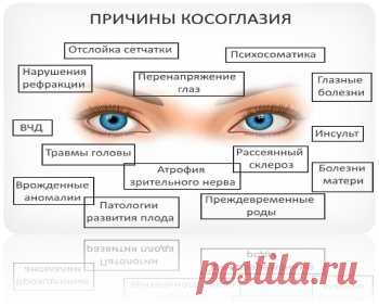 Лечение косоглазия - Кулинарист Кулинария у Вас дома