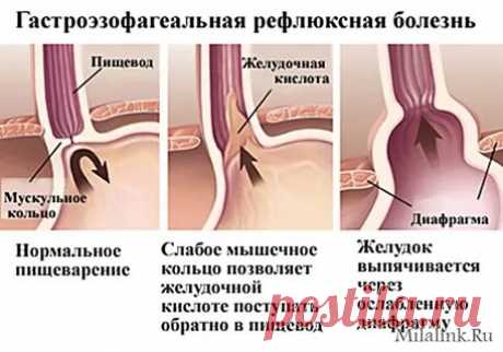 ЧТО ЭТО: ГЭРБ: 2 тыс изображений найдено в Яндекс Картинках