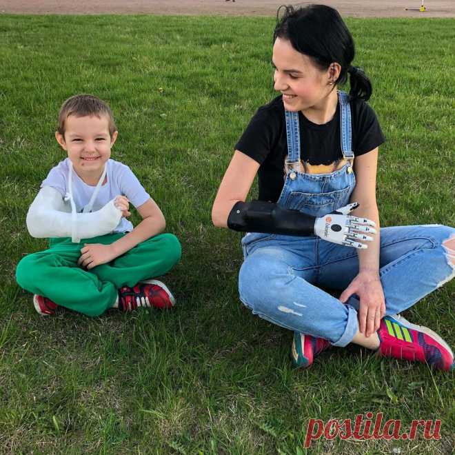 Мама двоих детей, которой бывший муж отрубил кисти рук, выходит замуж