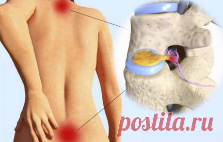 Боли в спине - психосоматические причины болей Спина- это место, где мы хороним те наши чувства и переживания, которые вызывали боль и растерянность. Спина представляет собой интересную смесь символов и значений. С одной стороны, это место, куда …