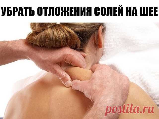 КАК УБРАТЬ ОТЛОЖЕНИЯ СОЛЕЙ НА ШЕЕ? ЭТО НУЖНО ЗНАТЬ ВСЕМ!

Отложение солей на шее называют остеохондрозом шейного отдела позвоночника. Вследствие того, что шейный отдел позвоночника является весьма важной частью организма, нарушения в этой области приводят к серьезным нарушениям всего организма. 

Область шеи является местом сосредоточения сосудов и нервов, питающих ткани шеи, лица, черепа. 
Кроме того, вследствие защемления нервных окончаний начинаются головные боли, онеме...