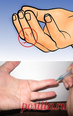 ОСОБАЯ ТОЧКА НА ПАЛЬЦЕ – СОХРАНИ!