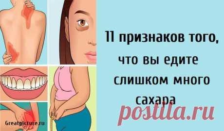 11 признаков того, что вы едите слишком много сахара 11 признаков того, что вы едите слишком много сахара.Сахар ассоциируется с различными проблемами со здоровьем, от кариеса и усталости до