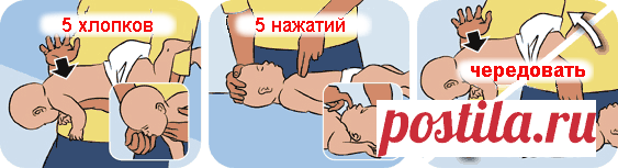 Что делать если подавился ребенок