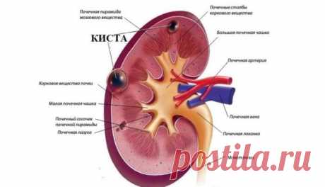 Народное лечение почек: рецепты