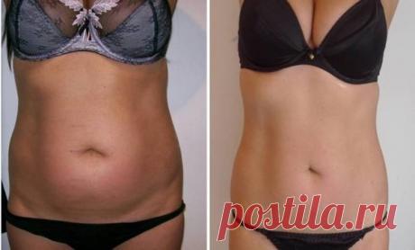 Это домашнее средство для похудения помогло мне полностью убрать жир на животе за 17 дней и похудеть на 7 кг | Худеем вместе | Яндекс Дзен