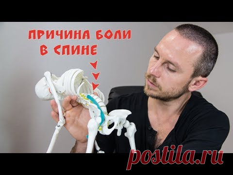 БОЛИТ СПИНА в области поясницы 🔴 Триггерные точки в подзвдошно-поясничной мышце (ППМ) ⭐ SLAVYOGA