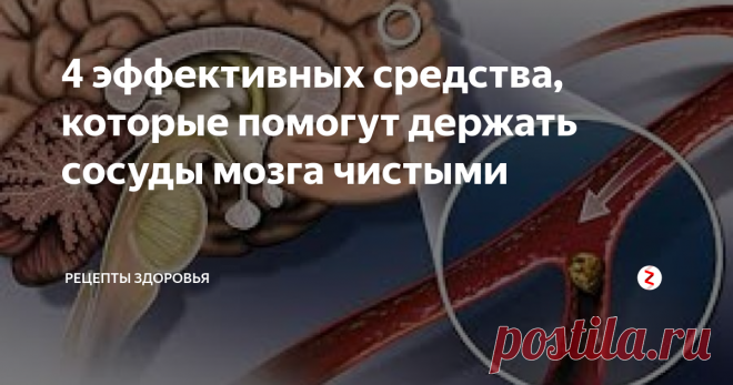 4 эффективных средства, которые помогут держать сосуды мозга чистыми Все говорят о чистоте артерий, по которым кровь переносит полезные вещества и кислород к органам и тканям тела. Вот только, нужно учесть, что особое внимание нужно уделять сосудам головного мозга. В особенности обратить на это внимание нужно абсолютно всем людям достигшим 40 лет. Кроме того, если вы моложе, но у вас ухудшение памяти, шейный остеохондроз, постоянные головные боли, снизился слух и з