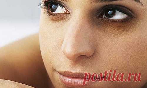 Темные круги под глазами - причины возникновения и как их убрать. Рецепты народной медицины на сайте