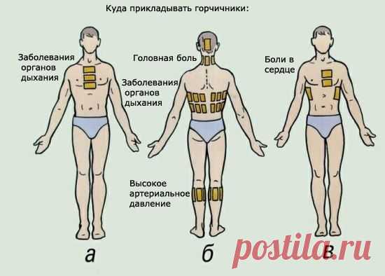 как правильно ставить горчичники