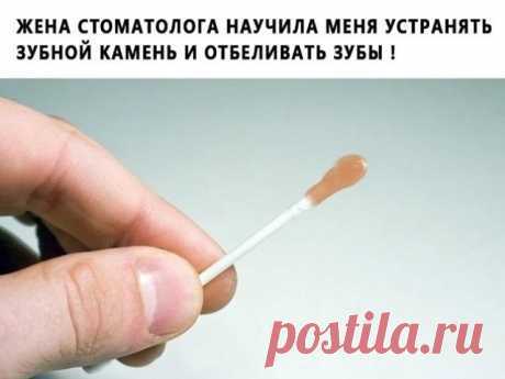 ЖЕНА СТОМАТОЛОГА НАУЧИЛА МЕНЯ УСТРАНЯТЬ ЗУБНОЙ КАМЕНЬ И ОТБЕЛИВАТЬ ЗУБЫ БЫСТРО И ПРОСТО!