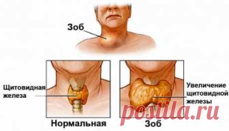 Очень эффективные бабушкины рецепты Возьмите на заметку!