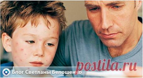 Как проявляется ветрянка у детей и взрослых? Вначале появляются признаки простуды - кашель, насморк, а после на теле появляются прыщи красного цвета. Фото ветрянки.
