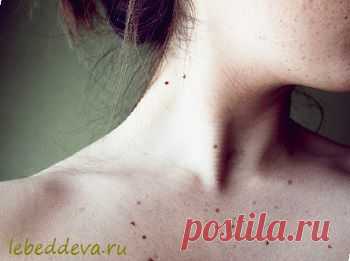 Родинки с точки зрения психологии - Дева-Лебедь | Дева-Лебедь