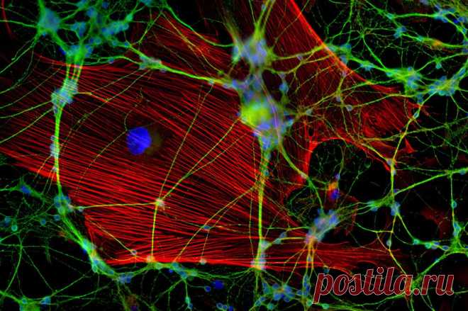 водоросли под микроскопом - Поиск в Google