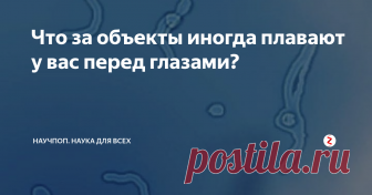 Что за объекты иногда плавают у вас перед глазами? Обращали ли вы внимание на то, что иногда вы видите, как какие-то невесомые объекты парят в воздухе перед вашими глазами? Они могут походить на маленькие шерстинки, напоминать по форме крошечных червячков, паутинки или прозрачные сгустки.
Muscae valitantes или 