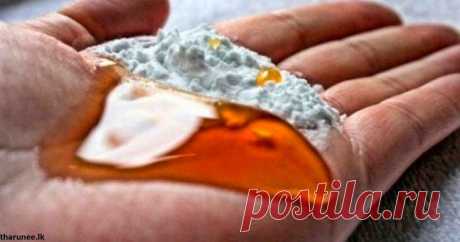 16 проблем, с которыми могут справиться обычная сода и касторовое масло Избавиться от боли в суставах, проблем с ЖКТ, улучшить состояние кожи - для этого всего нужны только 2 ингредиента. Это - сода и касторовое масло. Они - уникальные и универсальные средства от многих недугов...